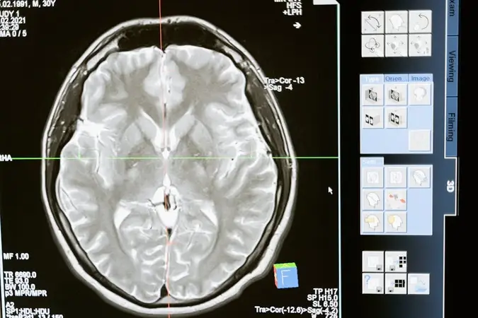 Computer screen showing a grey axial MRI brain scan with imaging software controls on the right